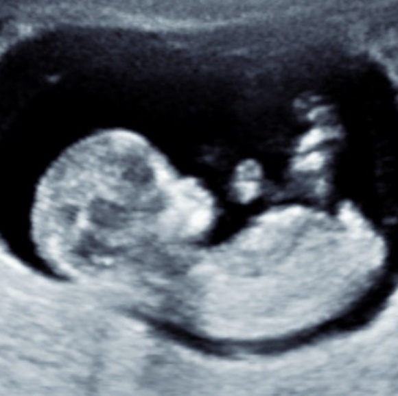 Meet your Posher, Azhari - Picture 1 of 1